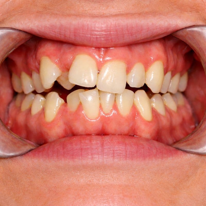 Before Nov 14, 2024, 8:12:30 AM